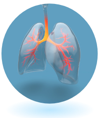 Asthma is a long-term condition that can lead to inflamed airways